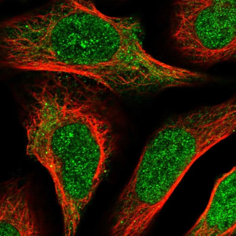 ZRANB1/Trabid Antibody - BSA Free Immunohistochemistry-Paraffin: ZRANB1/Trabid Antibody - BSA Free [NBP1-86916]