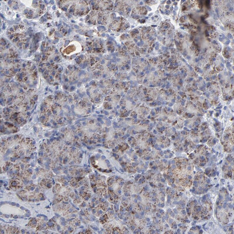 TXNRD2 Antibody - BSA Free Immunohistochemistry-Paraffin: TXNRD2 Antibody - BSA Free [NBP1-86919]