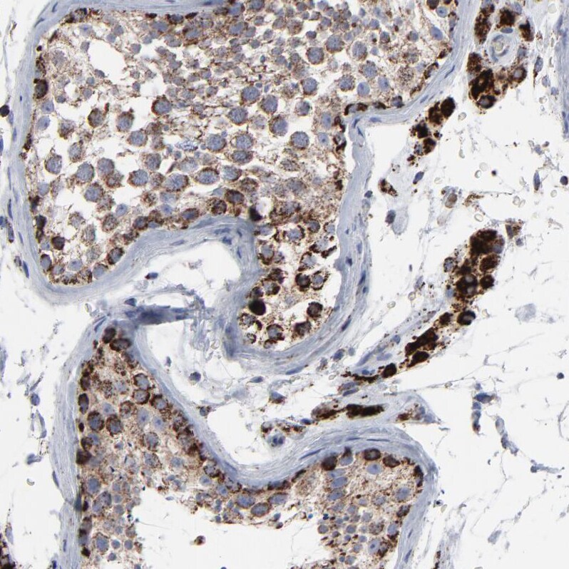 TXNRD2 Antibody - BSA Free Immunohistochemistry-Paraffin: TXNRD2 Antibody - BSA Free [NBP1-86919]