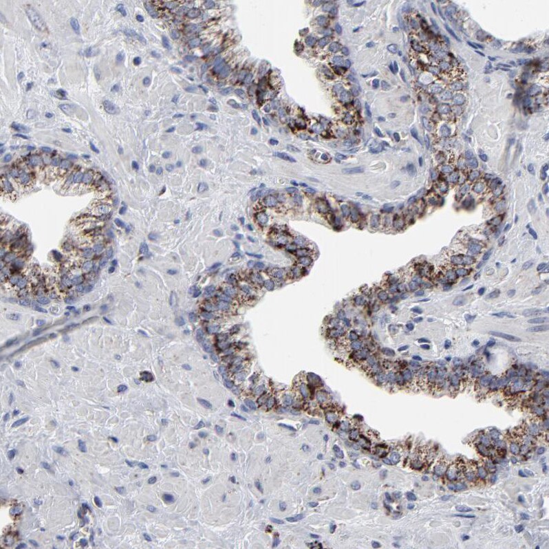 TXNRD2 Antibody - BSA Free Immunohistochemistry-Paraffin: TXNRD2 Antibody - BSA Free [NBP1-86919]