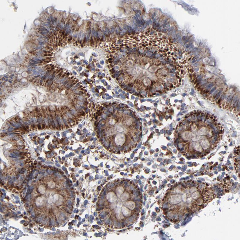 TXNRD2 Antibody - BSA Free Immunohistochemistry-Paraffin: TXNRD2 Antibody - BSA Free [NBP1-86919]