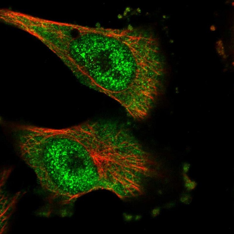 DNAJC7 Antibody - BSA Free Immunocytochemistry/ Immunofluorescence: DNAJC7 Antibody [NBP1-86920]