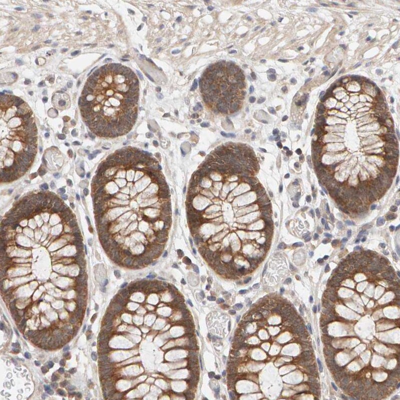DNAJC7 Antibody - BSA Free Immunohistochemistry-Paraffin: DNAJC7 Antibody - BSA Free [NBP1-86920]