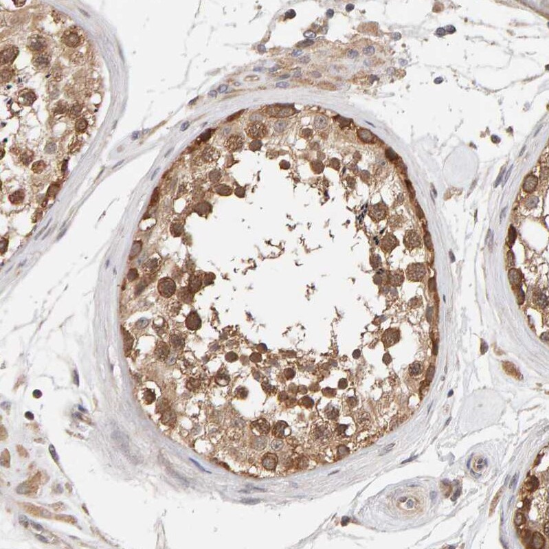 DNAJC7 Antibody - BSA Free Immunohistochemistry-Paraffin: DNAJC7 Antibody - BSA Free [NBP1-86920]