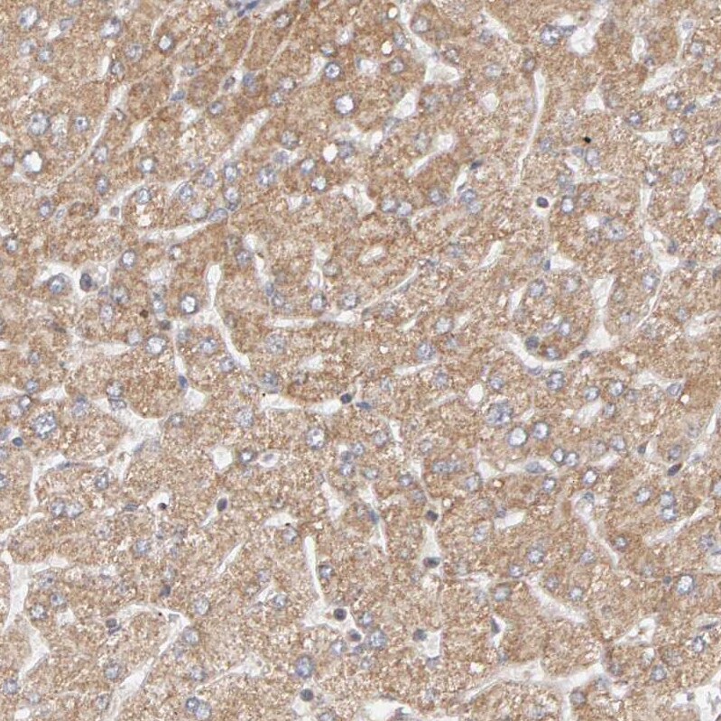 DNAJC7 Antibody - BSA Free Immunohistochemistry-Paraffin: DNAJC7 Antibody - BSA Free [NBP1-86920]