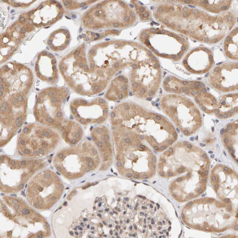 DNAJC7 Antibody - BSA Free Immunohistochemistry-Paraffin: DNAJC7 Antibody - BSA Free [NBP1-86920]