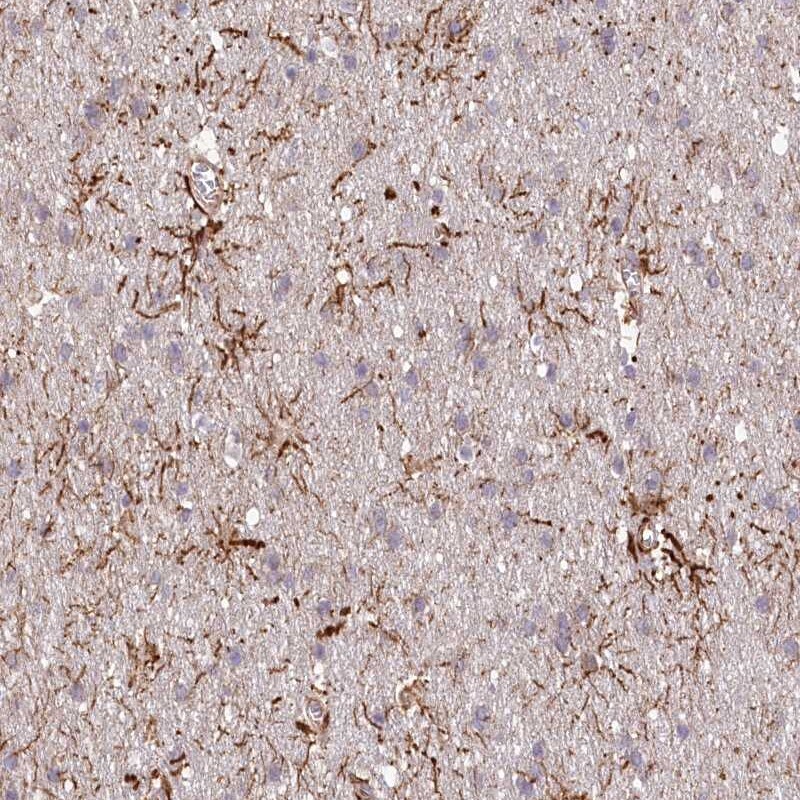 TTC1 Antibody - BSA Free Immunohistochemistry-Paraffin: TTC1 Antibody [NBP1-86921]