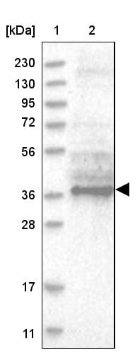 TTC1 Antibody - BSA Free Western Blot: TTC1 Antibody - BSA Free [NBP1-86921]