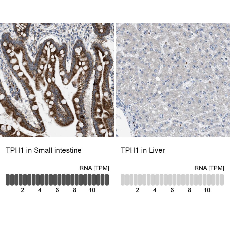 Tryptophan Hydroxylase 1/TPH-1 Antibody - BSA Free Immunohistochemistry-Paraffin: Tryptophan Hydroxylase 1/TPH-1 Antibody [NBP1-86922]