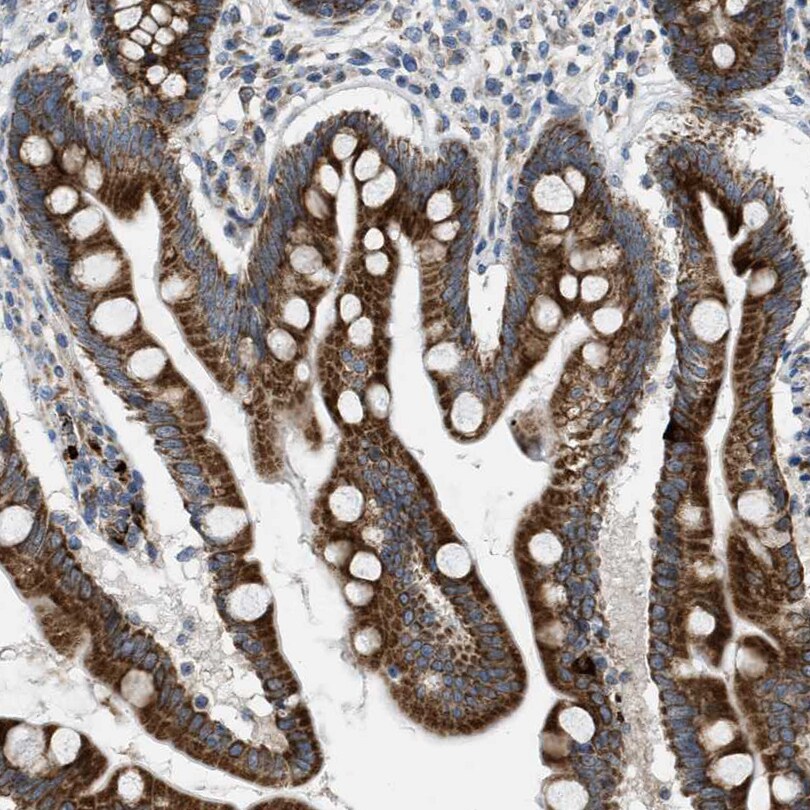 Tryptophan Hydroxylase 1/TPH-1 Antibody - BSA Free Immunohistochemistry-Paraffin: Tryptophan Hydroxylase 1/TPH-1 Antibody [NBP1-86922]