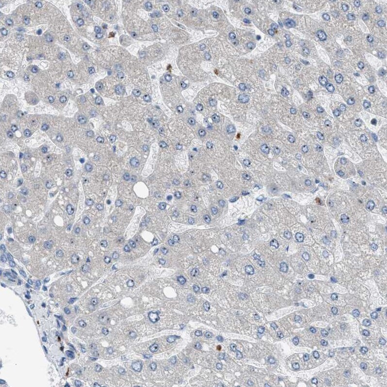 Tryptophan Hydroxylase 1/TPH-1 Antibody - BSA Free Immunohistochemistry-Paraffin: Tryptophan Hydroxylase 1/TPH-1 Antibody [NBP1-86922]