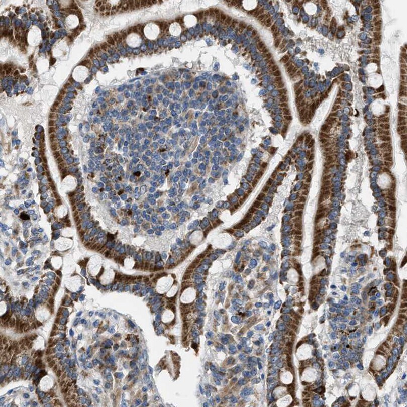 Tryptophan Hydroxylase 1/TPH-1 Antibody - BSA Free Immunohistochemistry-Paraffin: Tryptophan Hydroxylase 1/TPH-1 Antibody [NBP1-86922]