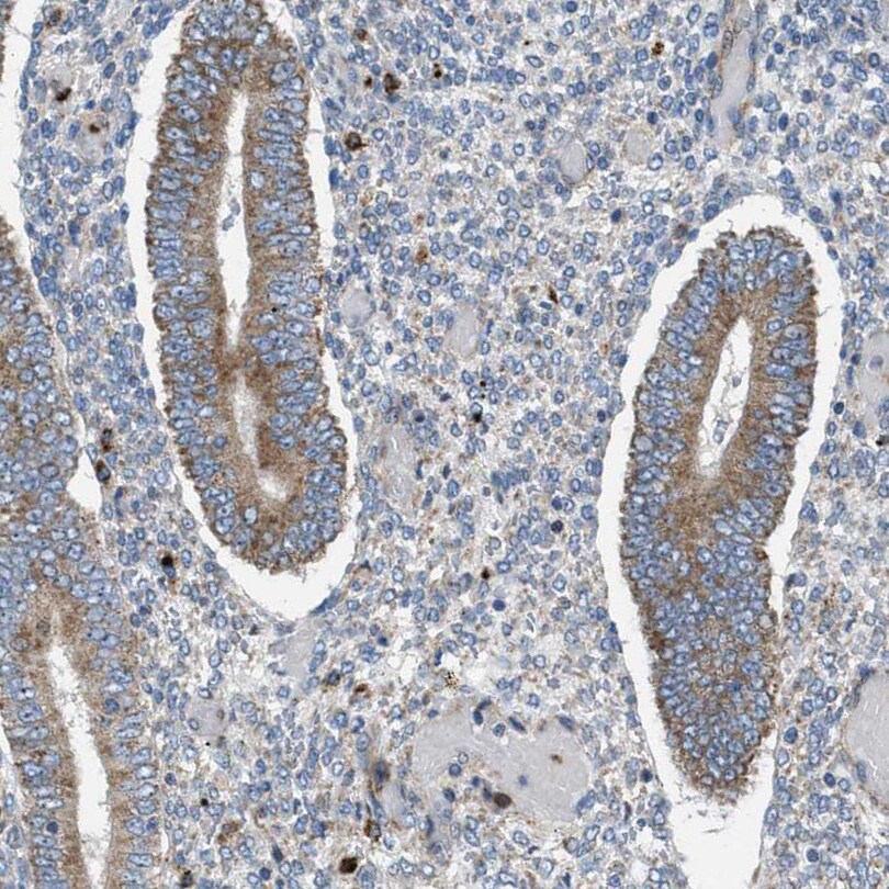 Tryptophan Hydroxylase 1/TPH-1 Antibody - BSA Free Immunohistochemistry-Paraffin: Tryptophan Hydroxylase 1/TPH-1 Antibody [NBP1-86922]