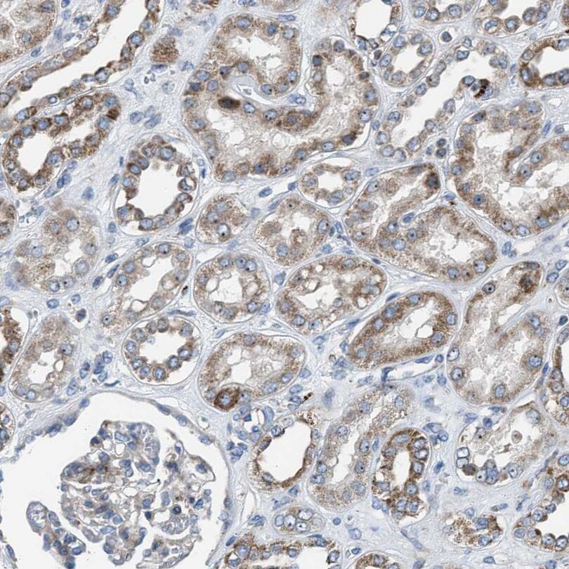 Tryptophan Hydroxylase 1/TPH-1 Antibody - BSA Free Immunohistochemistry-Paraffin: Tryptophan Hydroxylase 1/TPH-1 Antibody [NBP1-86922]