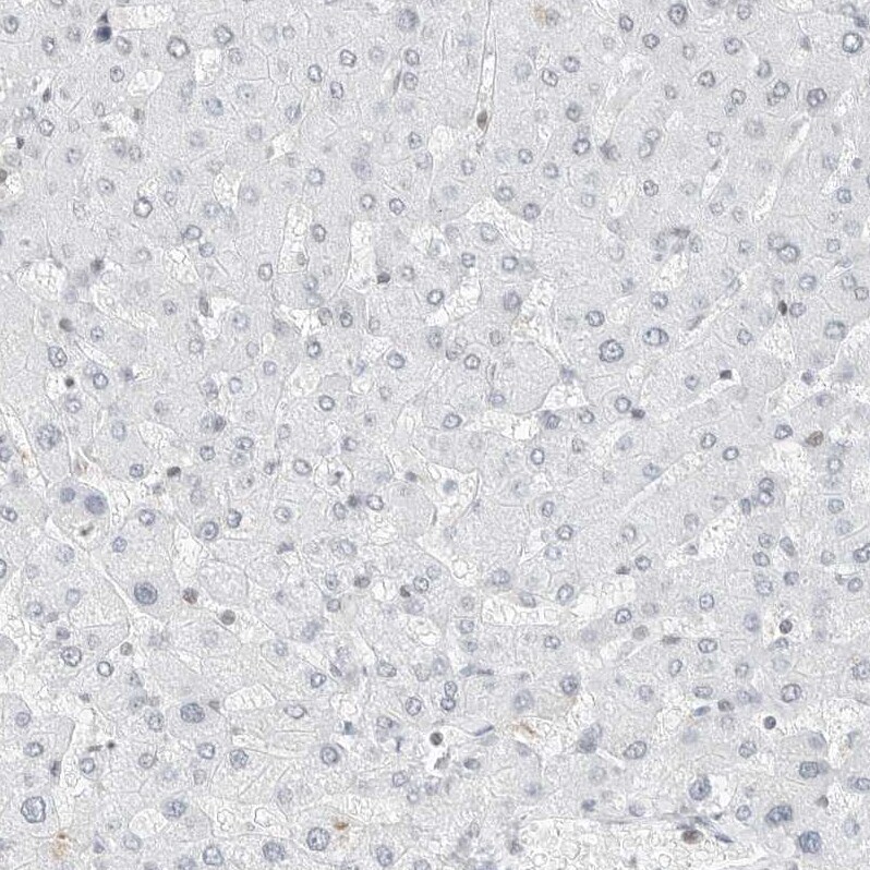 TORC2 Antibody - BSA Free Immunohistochemistry-Paraffin: TORC2 Antibody - BSA Free [NBP1-86925]