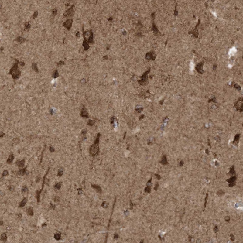 TRIM67 Antibody - BSA Free Immunohistochemistry-Paraffin: TRIM67 Antibody - BSA Free [NBP1-86929]
