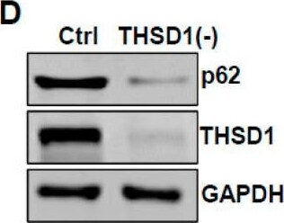 THSD1 Antibody - BSA Free