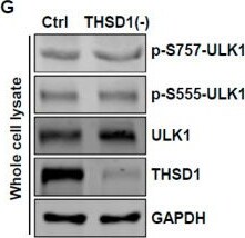 THSD1 Antibody - BSA Free