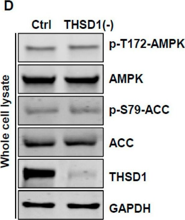 THSD1 Antibody - BSA Free