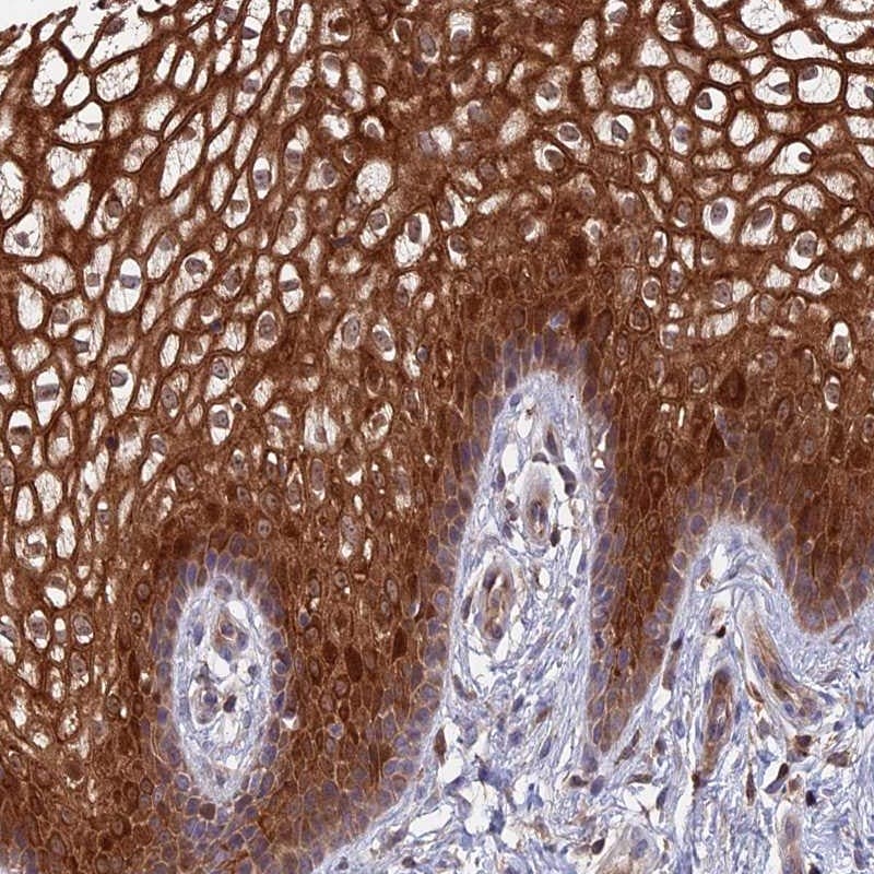 BAFF/BLyS/TNFSF13B Antibody Immunohistochemistry-Paraffin: RAB4B Antibody [NBP1-86933]