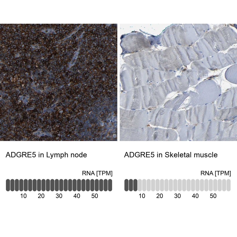CD97 Antibody - BSA Free Immunohistochemistry-Paraffin: CD97 Antibody - BSA Free [NBP1-86935]