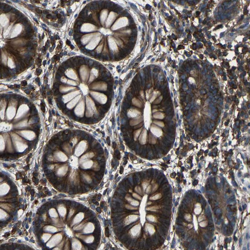 CD97 Antibody - BSA Free Immunohistochemistry-Paraffin: CD97 Antibody - BSA Free [NBP1-86935]