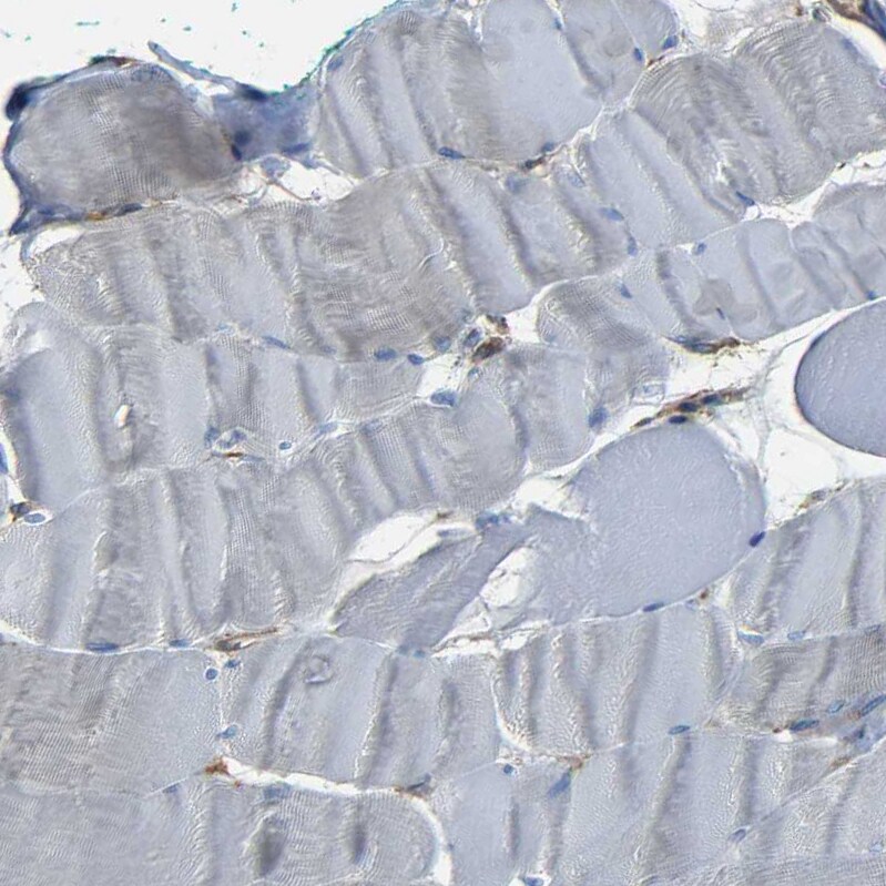 CD97 Antibody - BSA Free Immunohistochemistry-Paraffin: CD97 Antibody - BSA Free [NBP1-86935]