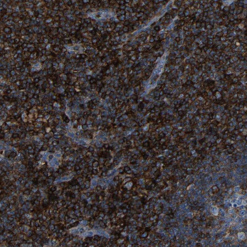 CD97 Antibody - BSA Free Immunohistochemistry-Paraffin: CD97 Antibody - BSA Free [NBP1-86935]