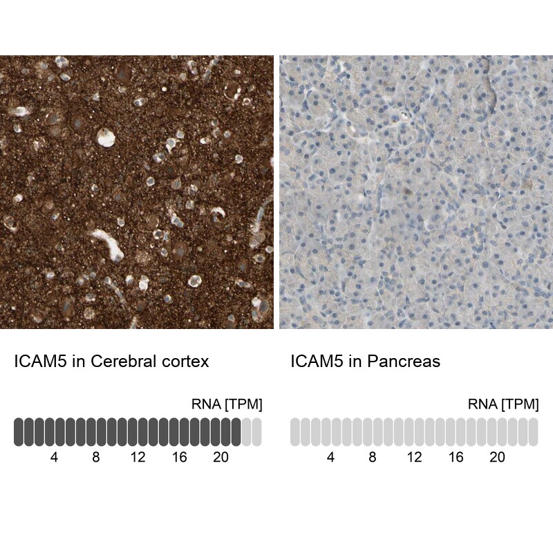 ICAM-5 Antibody - BSA Free Immunohistochemistry-Paraffin: ICAM-5 Antibody - BSA Free [NBP1-86938]