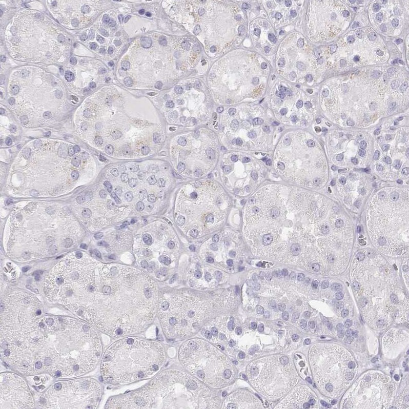 TKTL1 Antibody - BSA Free Immunohistochemistry-Paraffin: TKTL1 Antibody - BSA Free [NBP1-86939]