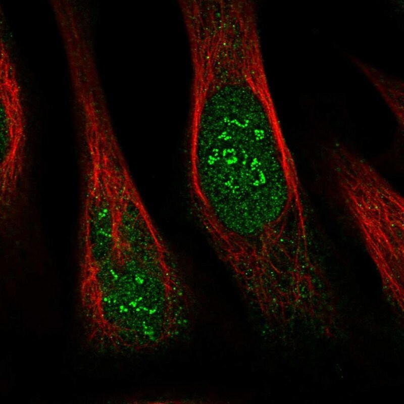 THYN1 Antibody - BSA Free Immunocytochemistry/ Immunofluorescence: THYN1 Antibody [NBP1-86942]