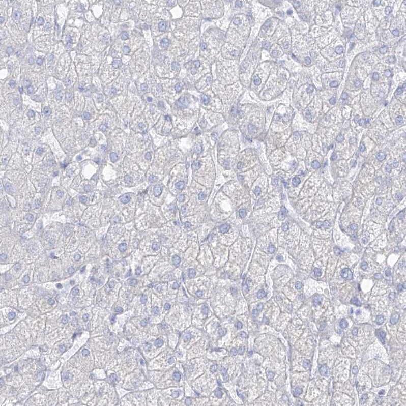 Transglutaminase 4/TGM4 Antibody - BSA Free Immunohistochemistry-Paraffin: Transglutaminase 4/TGM4 Antibody [NBP1-86947]