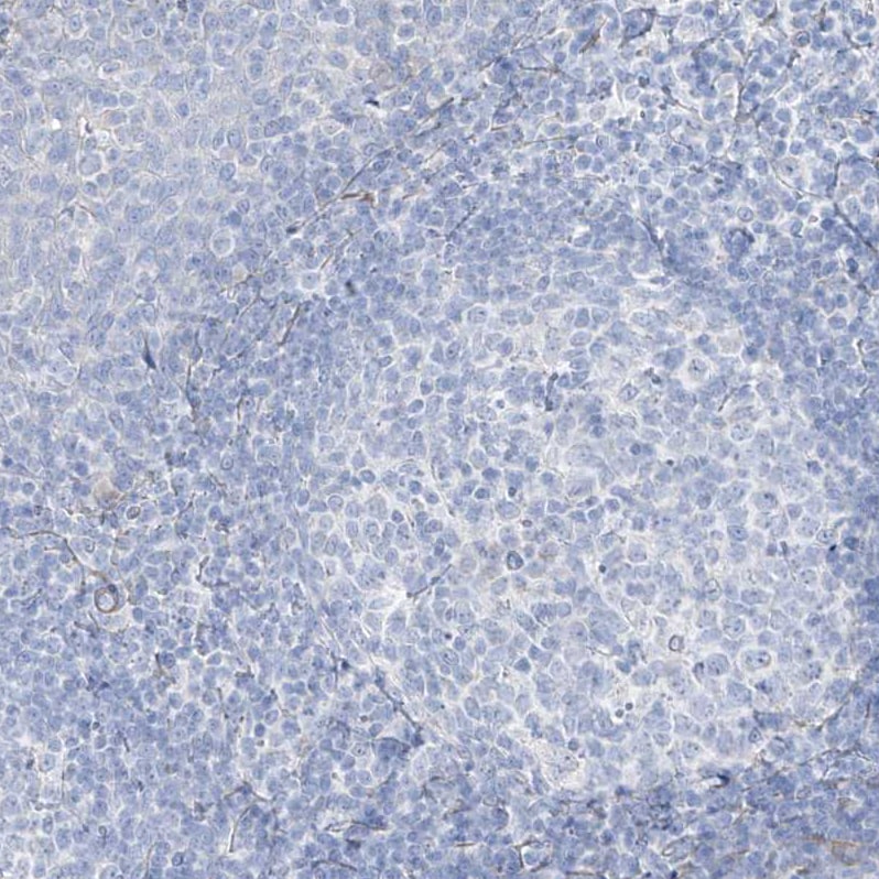 Transglutaminase 4/TGM4 Antibody - BSA Free Immunohistochemistry-Paraffin: Transglutaminase 4/TGM4 Antibody [NBP1-86947]