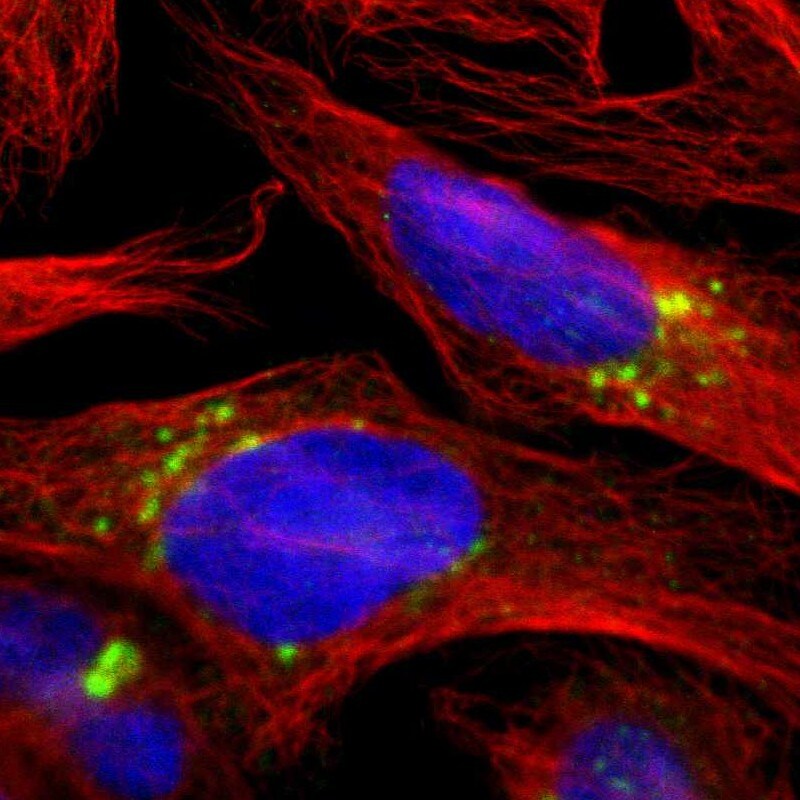 TGN46 Antibody - BSA Free Immunocytochemistry/ Immunofluorescence: TGN46 Antibody [NBP1-86948]