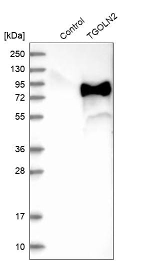 TGN46 Antibody - BSA Free Western Blot: TGN46 Antibody - BSA Free [NBP1-86949]