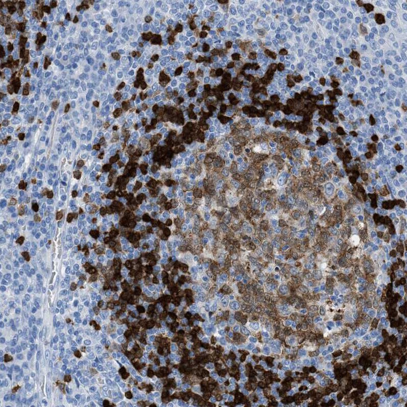 TCL1A Antibody Immunohistochemistry-Paraffin: TCL1A Antibody [NBP1-86958]