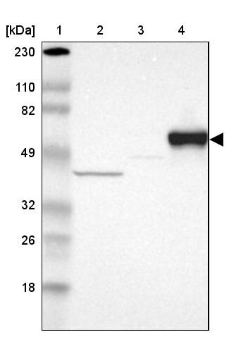 Serpin A7/TBG Antibody - BSA Free Western Blot: Serpin A7/TBG Antibody - BSA Free [NBP1-86963]