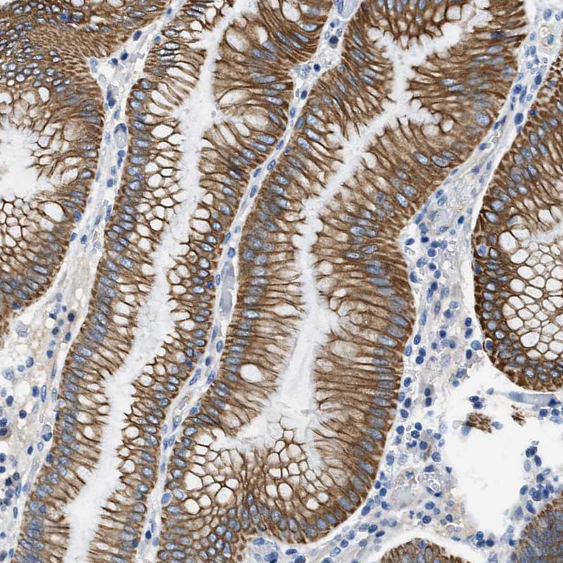 TauT/SLC6A6 Antibody - BSA Free Immunohistochemistry-Paraffin: TauT/SLC6A6 Antibody - BSA Free [NBP1-86964]