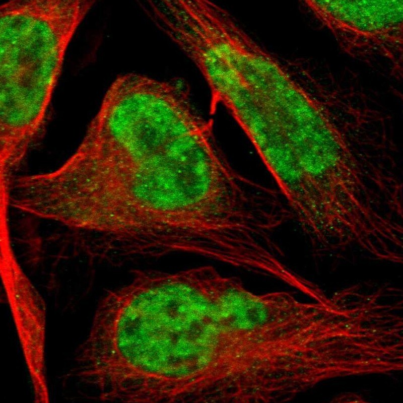HIV-1 Tat specific factor 1 Antibody - BSA Free Immunocytochemistry/ Immunofluorescence: HIV-1 Tat specific factor 1 Antibody [NBP1-86966]