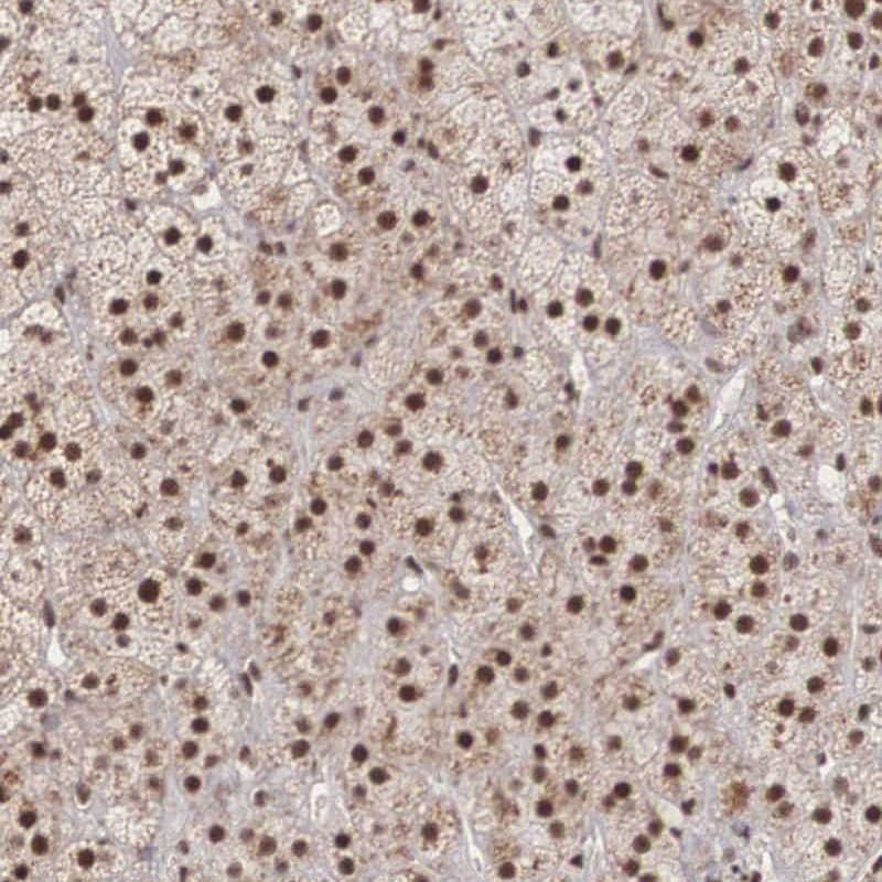 HIV-1 Tat specific factor 1 Antibody - BSA Free Immunohistochemistry-Paraffin: HIV-1 Tat specific factor 1 Antibody [NBP1-86966]