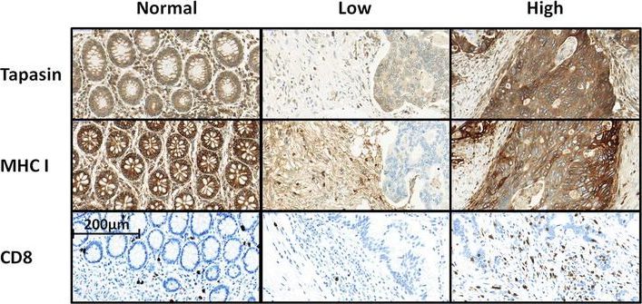 Tapasin Antibody
