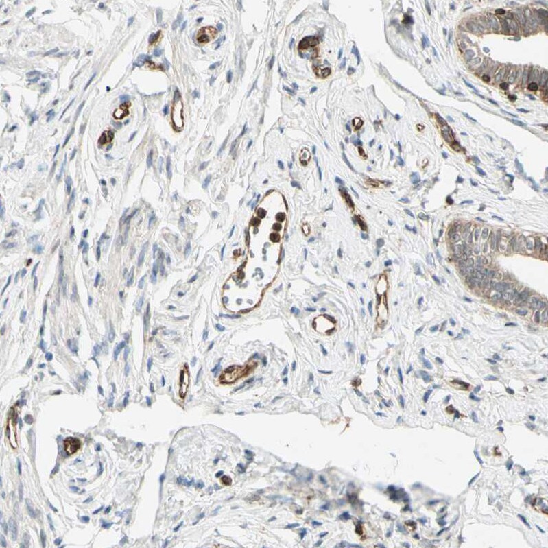 Tapasin Antibody - BSA Free Immunohistochemistry-Paraffin: Tapasin Antibody - BSA Free [NBP1-86968]