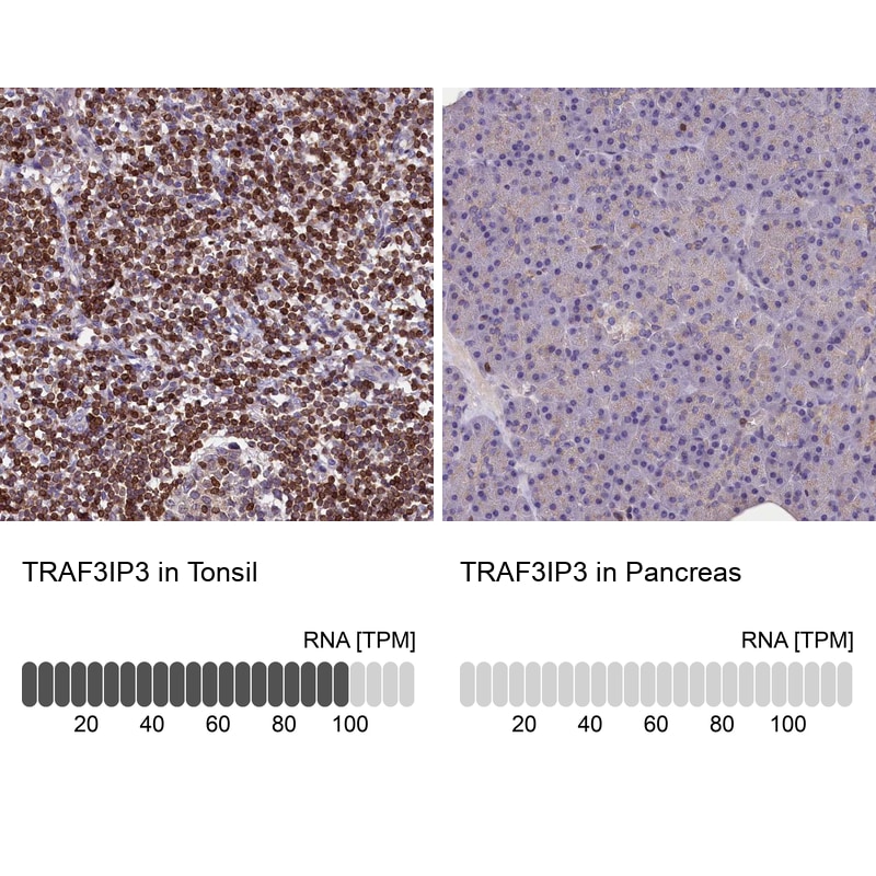 TRAF3IP3 Antibody - BSA Free Immunohistochemistry-Paraffin: TRAF3IP3 Antibody [NBP1-86974]