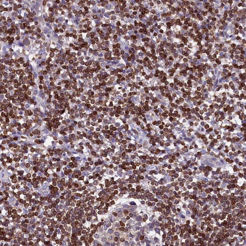 TRAF3IP3 Antibody - BSA Free Immunohistochemistry-Paraffin: TRAF3IP3 Antibody [NBP1-86974]