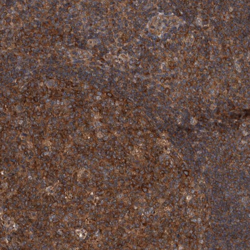 RIOK3 Antibody - BSA Free Immunohistochemistry-Paraffin: RIOK3 Antibody - BSA Free [NBP1-86982]