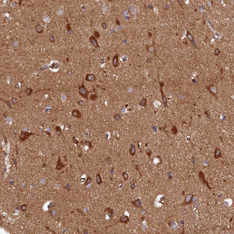 Syntaxin 12 Antibody - BSA Free Immunohistochemistry-Paraffin: Syntaxin 12 Antibody - BSA Free [NBP1-86985]