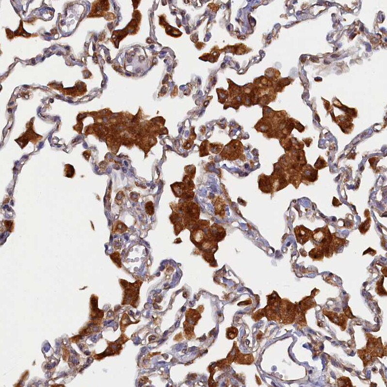 Syntaxin 12 Antibody - BSA Free Immunohistochemistry-Paraffin: Syntaxin 12 Antibody - BSA Free [NBP1-86985]