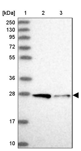 Syntaxin 12 Antibody - BSA Free Western Blot: Syntaxin 12 Antibody - BSA Free [NBP1-86985]