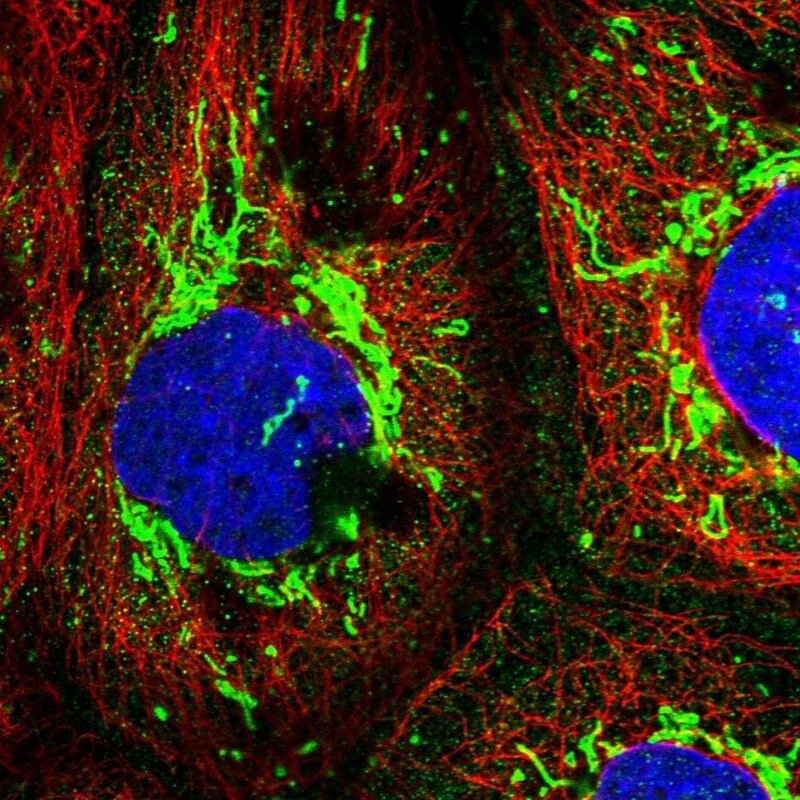 Ring finger protein 138 Antibody - BSA Free Immunohistochemistry-Paraffin: Ring finger protein 138 Antibody - BSA Free [NBP1-86987]