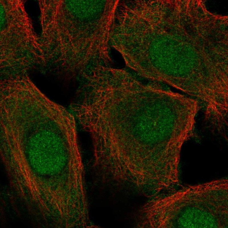 Cystatin A Antibody - BSA Free Immunohistochemistry-Paraffin: Cystatin A Antibody - BSA Free [NBP1-86989]